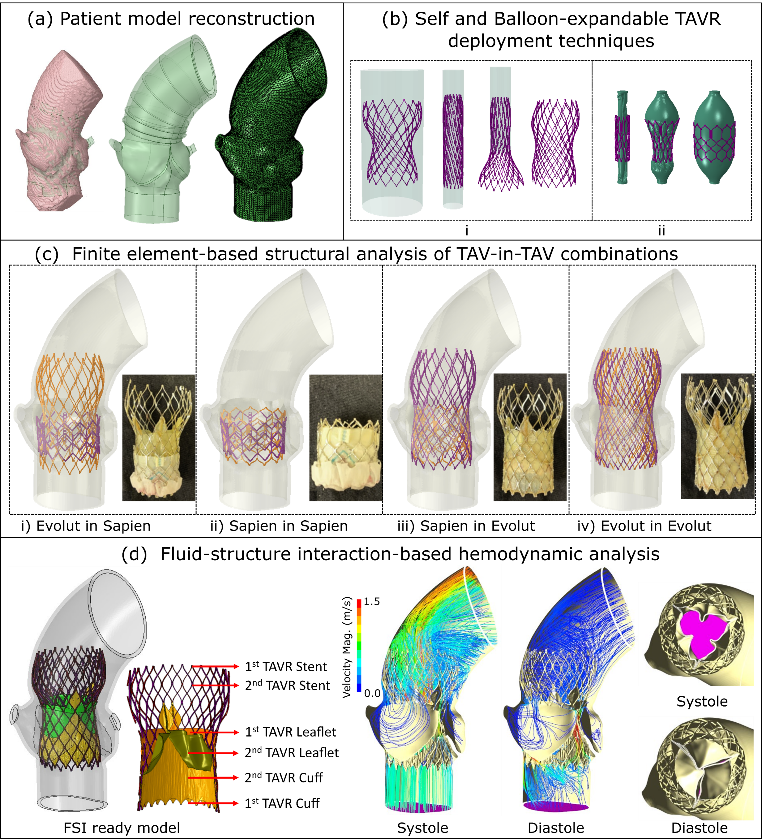 Redo-TAVR Feasibility Analysis Framework